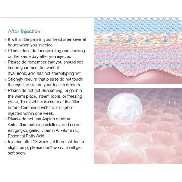 Hospital Neck Lines 1ml Hyaluronic Acid Filler Removing Neck Fine Wrinkles