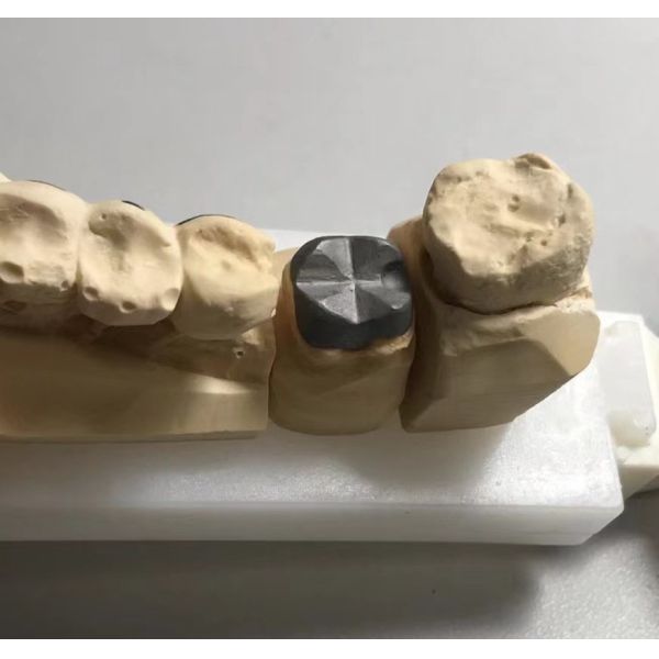 ISO FDA CE Dental Metal Post And Core Crown PFM Good Fit