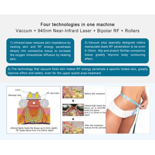 Velaslim Infrared Laser Vacuum Rolling Anti-Cellulite Rf Skin Tightening Machine Manufacturer、