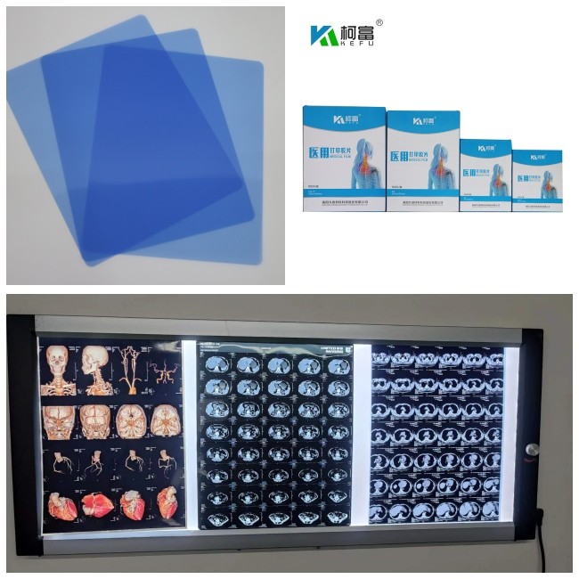 High Image Stability Blue Medical Inkjet Film For Long Lasting Performance