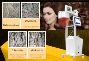 Quality 650nm Laser Hair Growth Machine Scalp Treatment Regrowth Salon Equipment wholesale