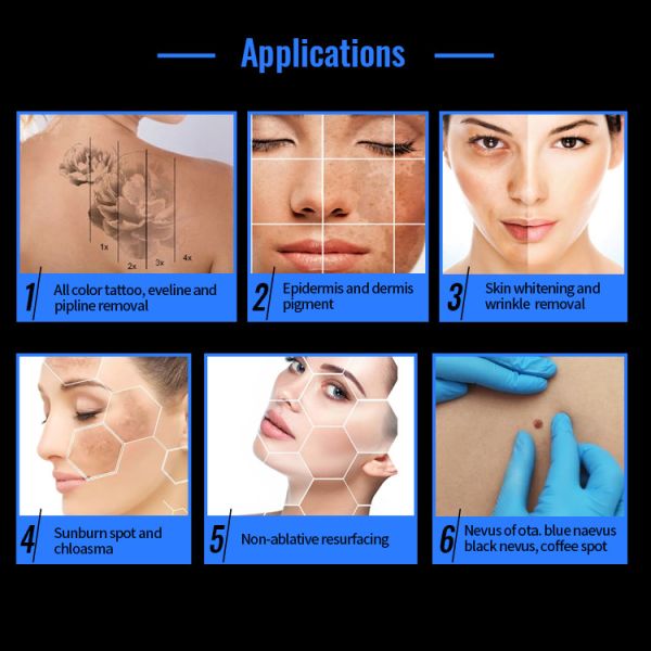 Air Water Cooling Q Switched Nd Yag Laser for Precise Laser Treatment Pulse Width 4-6ns